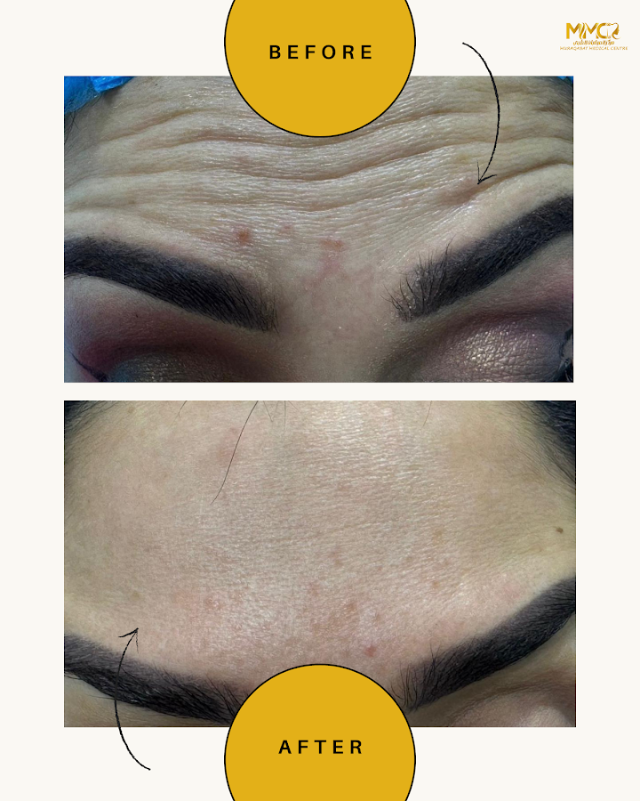 Muraqabat Aesthetic Clinic Dubai — photo 5
