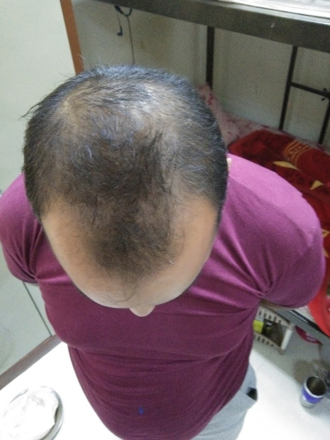 Gulfgate Hair Fixing Jeddah