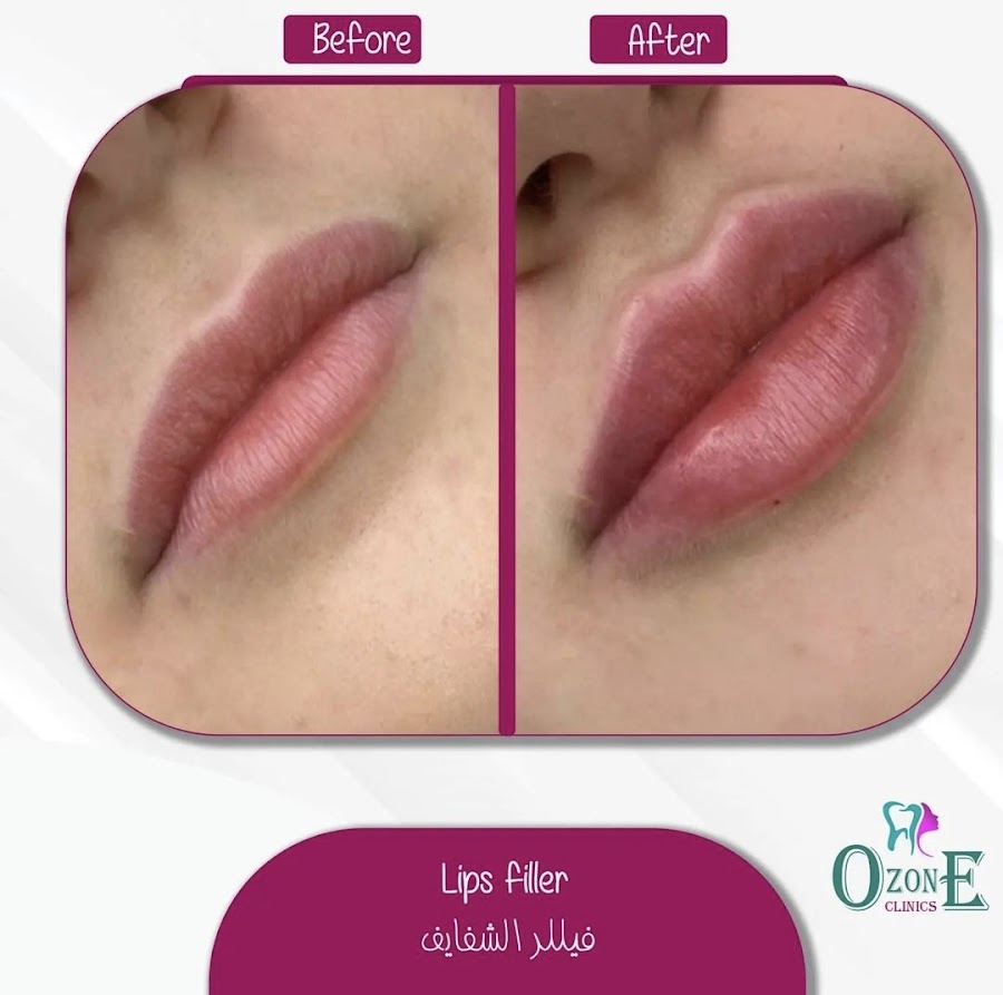 Ozone clinics عيادات اوزون — photo 5