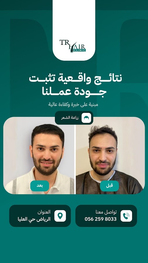 TR Hair Transplant Specialized Clinic | تي ار زراعة الشعر العيادات المتخصصة — photo 2