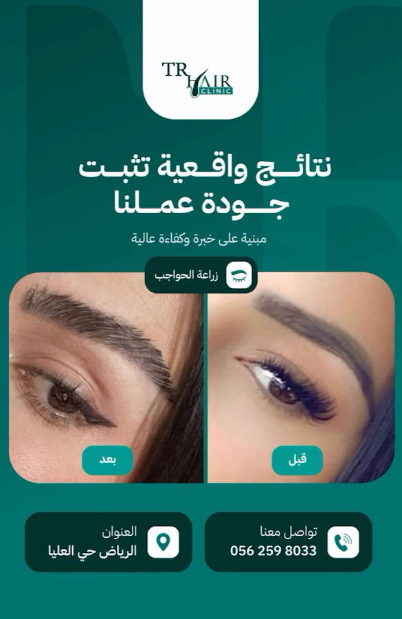 TR Hair Transplant Specialized Clinic | تي ار زراعة الشعر العيادات المتخصصة — photo 5