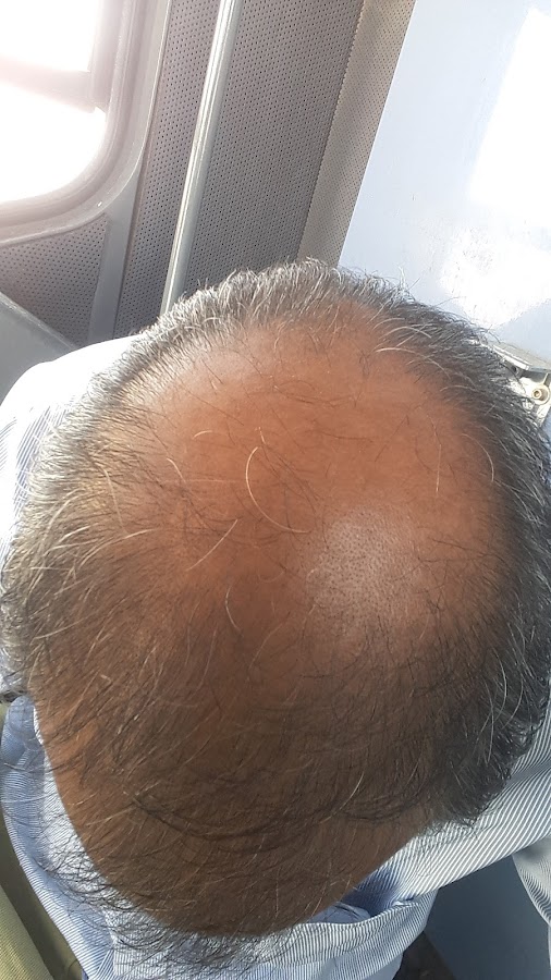 Gulfgate Hair Fixing Riyadh